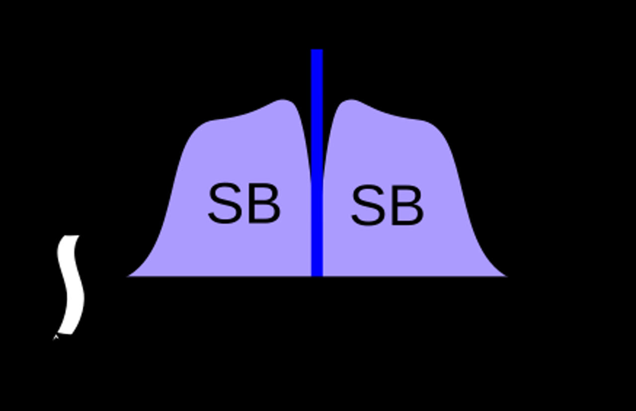 Audio frequency spectrum waveform visualization